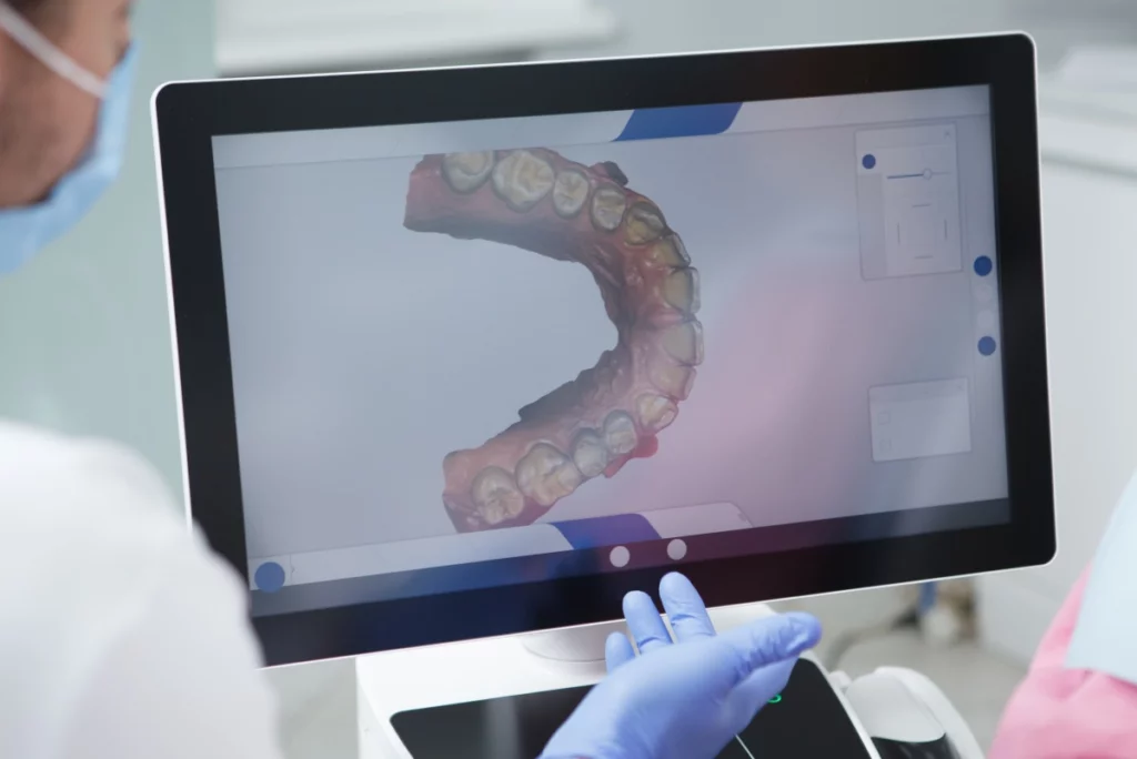 3D-Scan des Gebisses für die Anfertigung der Alignerschienen